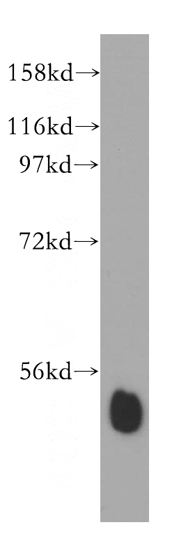mouse skeletal muscle tissue were subjected to SDS PAGE followed by western blot with Catalog No:114710(RING1 antibody) at dilution of 1:500