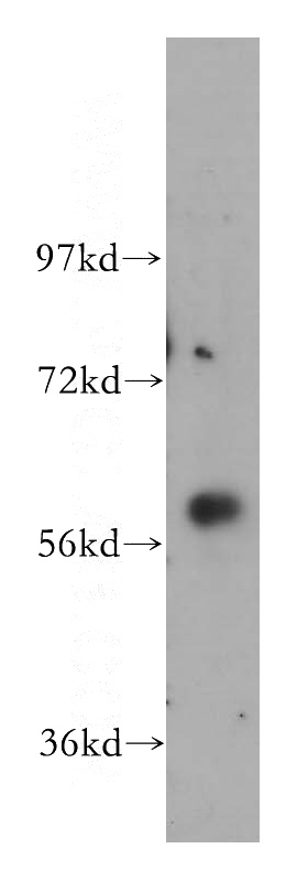 HeLa cells were subjected to SDS PAGE followed by western blot with Catalog No:111015(GK3P antibody) at dilution of 1:500