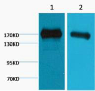Western blot analysis of 1) A431, 2) Hela, diluted at 1:2000.