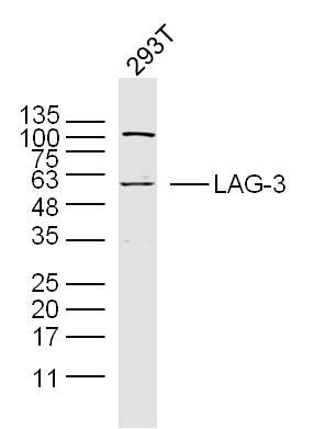 Fig1: Sample: 293T Cell (Human) Lysate at 40 ug; Primary: Anti-LAG-3 at 1/300 dilution; Secondary: IRDye800CW Goat Anti-Rabbit IgG at 1/20000 dilution; Predicted band size: 58 kD; Observed band size: 58 kD