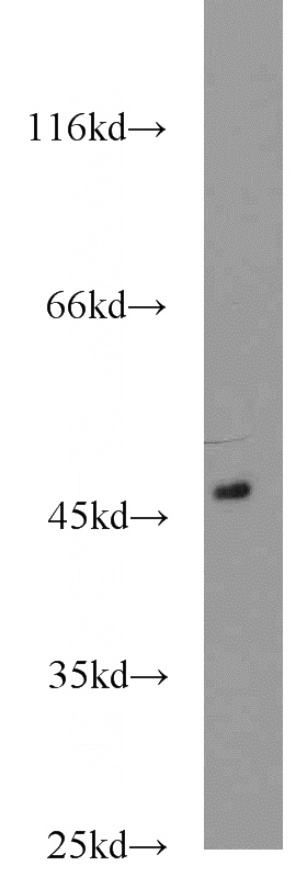 mouse kidney tissue were subjected to SDS PAGE followed by western blot with Catalog No:107718(ACADL antibody) at dilution of 1:1000