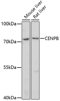 Western blot - CENPB Polyclonal Antibody 