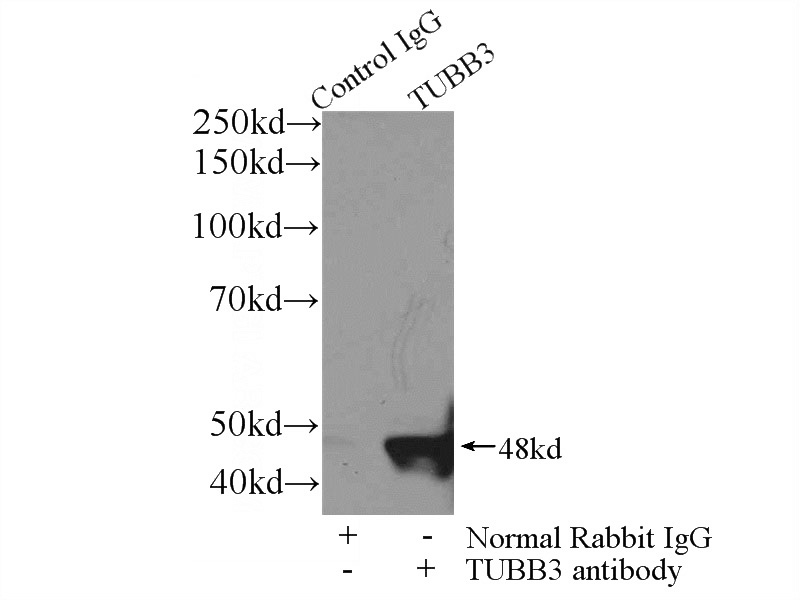 IP Result of anti-Tubulin-beta (IP:Catalog No:117306, 3ug; Detection:Catalog No:117306 1:1000) with mouse brain tissue lysate 3600ug.