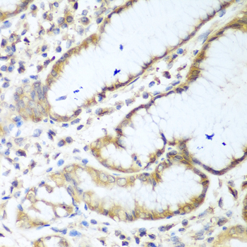 Immunohistochemistry - NUDT15 Polyclonal Antibody 