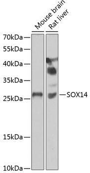 Western blot - SOX14 Polyclonal Antibody 