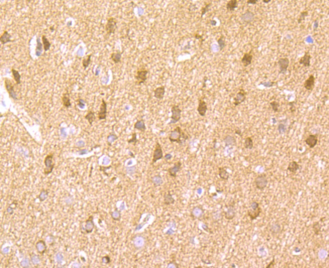 Fig3: Immunohistochemical analysis of paraffin-embedded rat brain tissue using anti-LNP antibody. Counter stained with hematoxylin.
