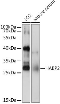 Western blot - HABP2 Polyclonal Antibody 