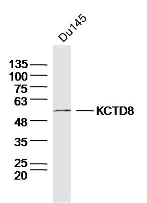 Fig1: Sample: Du145 Cell (Human) Lysate at 30 ug; Primary: Anti-KCTD8 at 1/300 dilution; Secondary: IRDye800CW Goat Anti-Rabbit IgG at 1/20000 dilution; Predicted band size: 52kD; Observed band size: 52kD