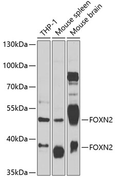 Western blot - FOXN2 Polyclonal Antibody 
