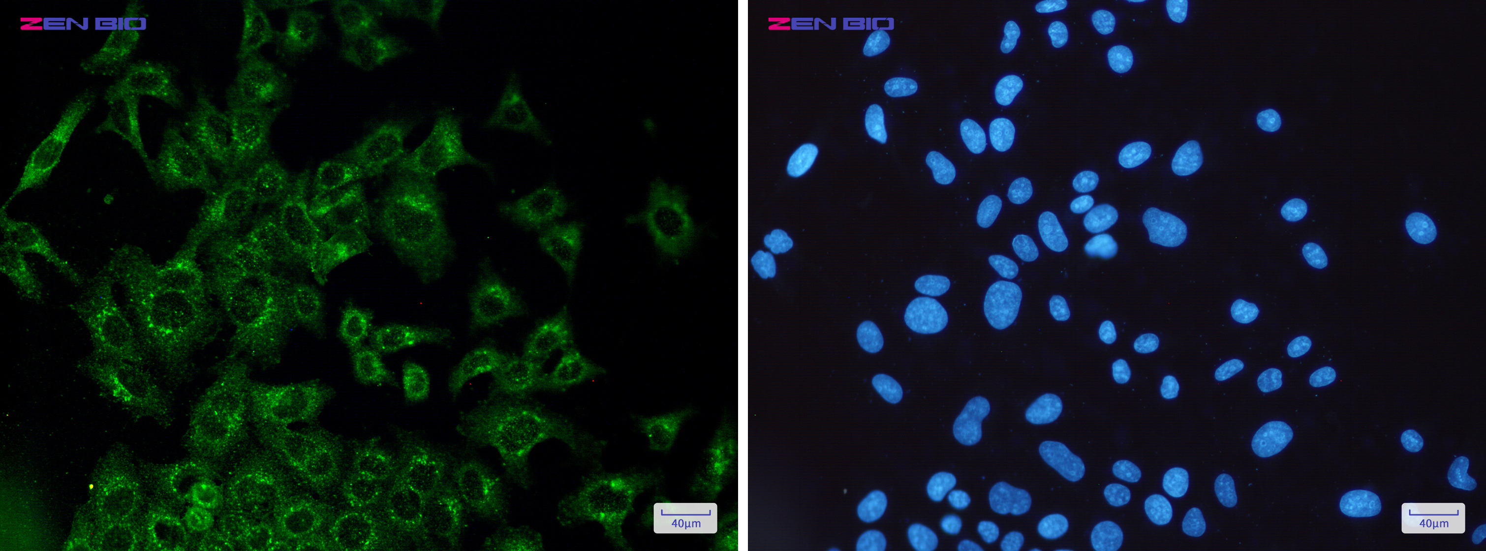 Immunocytochemistry of VEGFD(green) in Hela cells using VEGFD Rabbit mAb at dilution 1/50, and DAPI(blue)