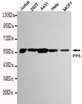 Western blot detection of PP5 in Hela,Jurkat,293T,A431 and MCF7 cell lysates using PP5 mouse mAb (1:1000 diluted).Predicted band size: 57kDa.Observed band size: 57kDa.