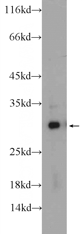 HEK-293 cells were subjected to SDS PAGE followed by western blot with Catalog No:108691(C20orf11 Antibody) at dilution of 1:1000