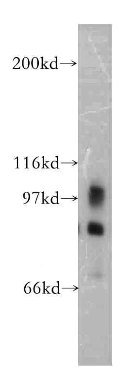 mouse brain tissue were subjected to SDS PAGE followed by western blot with Catalog No:113926(PLA2G4D antibody) at dilution of 1:500