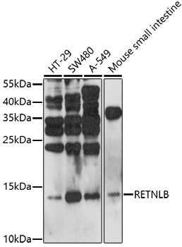 Western blot - RETNLB Polyclonal Antibody 