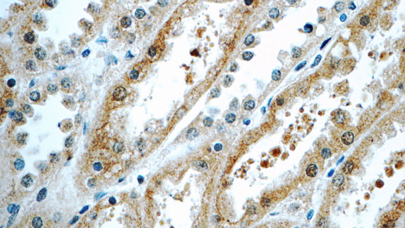 Immunohistochemistry of paraffin-embedded human kidney tissue slide using Catalog No:115051(SAMD14 Antibody) at dilution of 1:50 (under 40x lens)