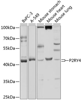 Western blot - P2RY4 Polyclonal Antibody 