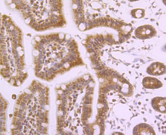 Fig5: Immunohistochemical analysis of paraffin-embedded mouse colon tissue using anti-NaV1.7 beta antibody. Counter stained with hematoxylin.