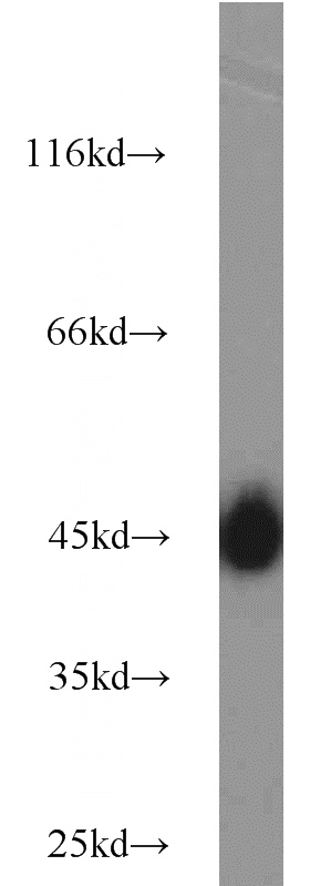 Y79 cells were subjected to SDS PAGE followed by western blot with Catalog No:111076(SLC2A1,GLUT1 antibody) at dilution of 1:1000