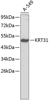 Western blot - KRT31 Polyclonal Antibody 