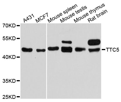 Western blot - TTC5 Polyclonal Antibody 