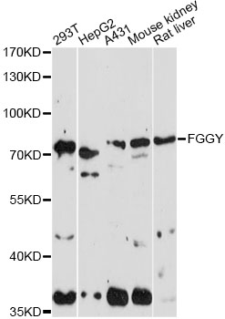 Western blot - FGGY Polyclonal Antibody 