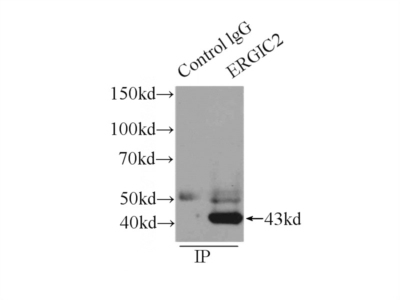 IP Result of anti-ERGIC2 (IP:Catalog No:110357, 4ug; Detection:Catalog No:110357 1:1000) with HepG2 cells lysate 2900ug.
