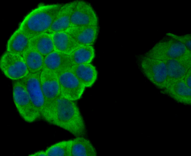 Fig1: ICC staining IL19 in Hela cells (green). The nuclear counter stain is DAPI (blue). Cells were fixed in paraformaldehyde, permeabilised with 0.25% Triton X100/PBS.