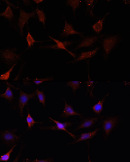 Immunofluorescence - GPER1 Polyclonal Antibody 