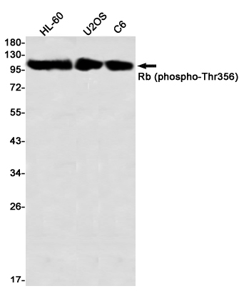 Western blot detection of Rb (phospho-Thr356) in HL-60,U2OS,C6 using Rb (phospho-Thr356) Rabbit mAb(1:1000 diluted)