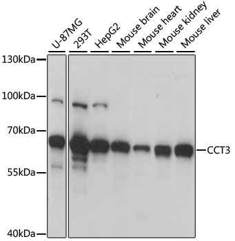 Western blot - CCT3 Polyclonal Antibody 