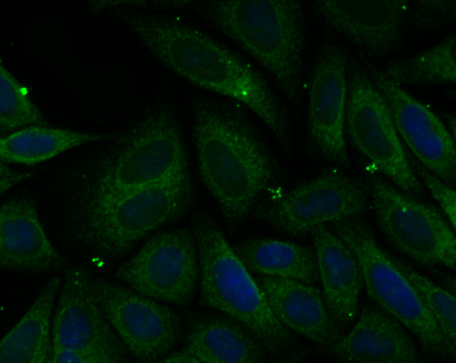 Fig4: ICC staining PHF8 in SiHa cells (green). The nuclear counter stain is DAPI (blue). Cells were fixed in paraformaldehyde, permeabilised with 0.25% Triton X100/PBS.