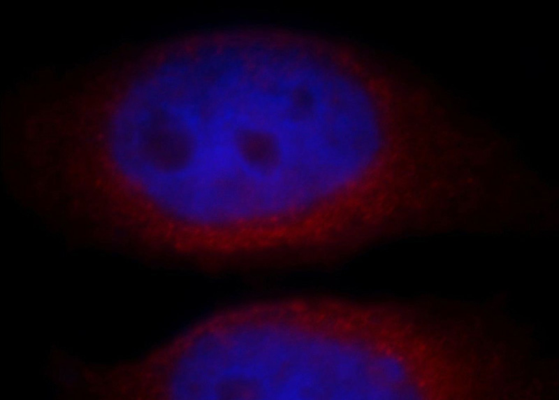 Immunofluorescent analysis of Hela cells, using C20orf149 antibody Catalog No:108693 at 1:25 dilution and Rhodamine-labeled goat anti-rabbit IgG (red). Blue pseudocolor = DAPI (fluorescent DNA dye).