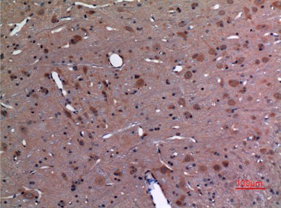 Fig2:; Immunohistochemical analysis of paraffin-embedded rat-brain, antibody was diluted at 1:100