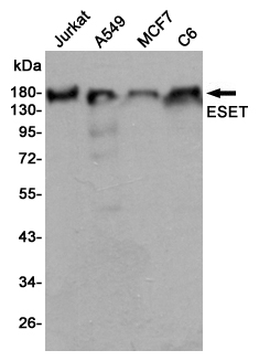 Western blot detection of ESET in Jurkat,A549,MCF7 and C6 cell lysates using ESET mouse mAb (1:2000 diluted).Predicted band size:180KDa.Observed band size:180KDa.