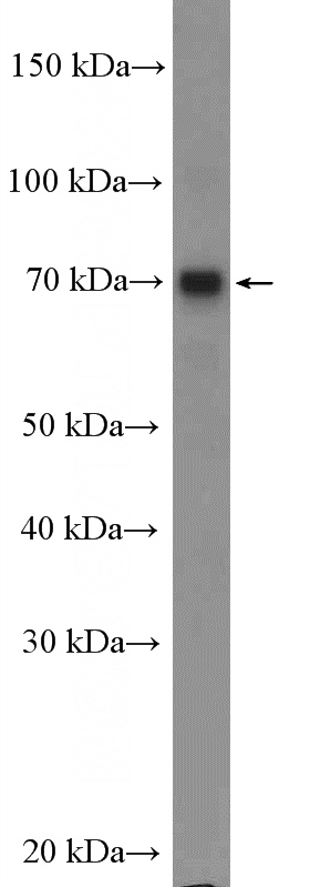A375 cells were subjected to SDS PAGE followed by western blot with Catalog No:112388(MAGEC3 Antibody) at dilution of 1:600