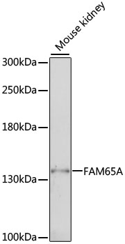 Western blot - FAM65A Polyclonal Antibody 