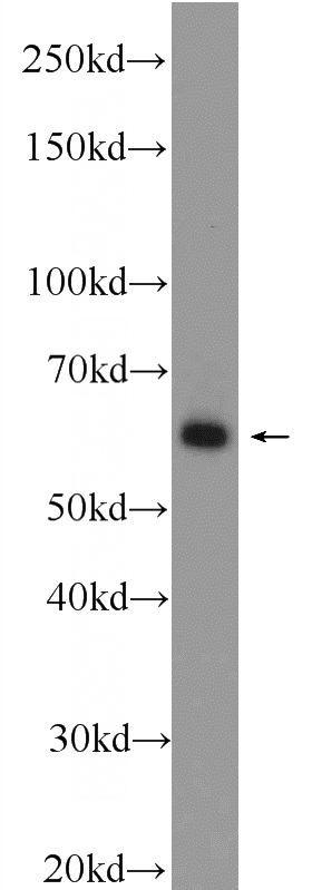 mouse brain tissue were subjected to SDS PAGE followed by western blot with Catalog No:110223(EHD1 Antibody) at dilution of 1:1000