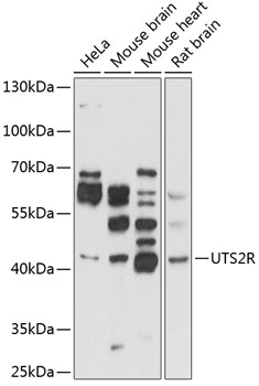 Western blot - UTS2R Polyclonal Antibody 