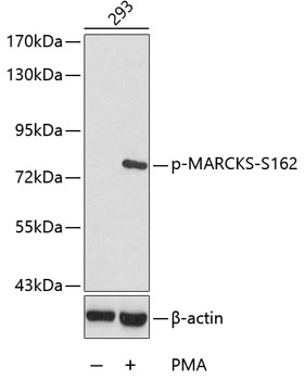 Western blot - Phospho-MARCKS-S162 pAb 
