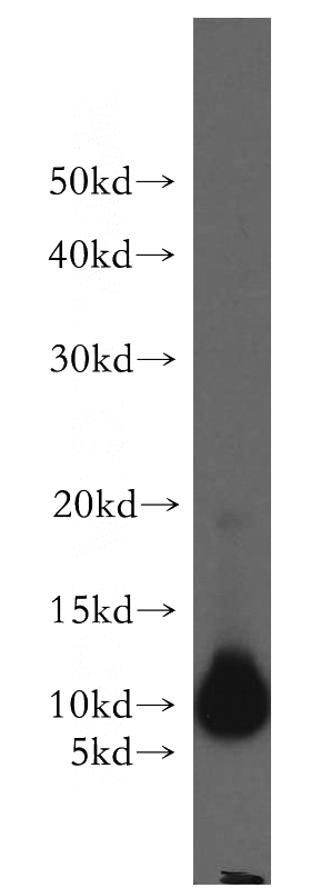 mouse pancreas tissue were subjected to SDS PAGE followed by western blot with Catalog No:108693(C20orf149 antibody) at dilution of 1:300