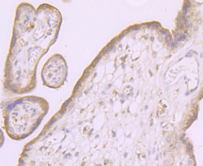 Fig4: Immunohistochemical analysis of paraffin-embedded human placenta tissue using anti-NaV1.7 antibody. Counter stained with hematoxylin.