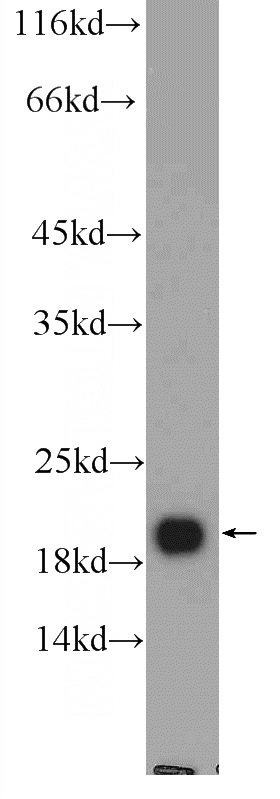 rat brain tissue were subjected to SDS PAGE followed by western blot with Catalog No:113026(NCALD Antibody) at dilution of 1:2000