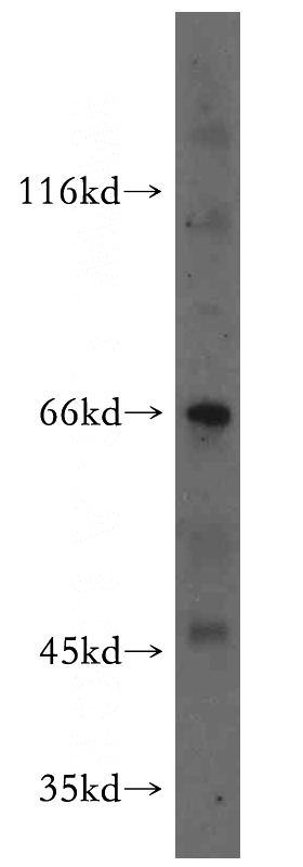 mouse liver tissue were subjected to SDS PAGE followed by western blot with Catalog No:112641(MEIS3 antibody) at dilution of 1:800