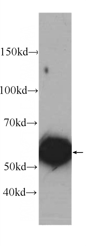 HepG2 cells were subjected to SDS PAGE followed by western blot with Catalog No:107226(CYP2D6 Antibody) at dilution of 1:1000