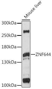Western blot - ZNF644 Polyclonal Antibody 