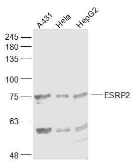 Fig1: Sample:; A431(Human) Cell Lysate at 30 ug; Hela(Human) Cell Lysate at 30 ug; HepG2(Human) Cell Lysate at 30 ug; Primary: Anti-ESRP2 at 1/1000 dilution; Secondary: IRDye800CW Goat Anti-Rabbit IgG at 1/20000 dilution; Predicted band size: 78 kD; Observed band size: 78 kD