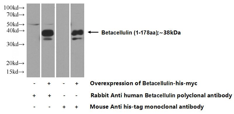 Transfected HEK-293 cells were subjected to SDS PAGE followed by western blot with Catalog No:117133(BTC Antibody) at dilution of 1:1000