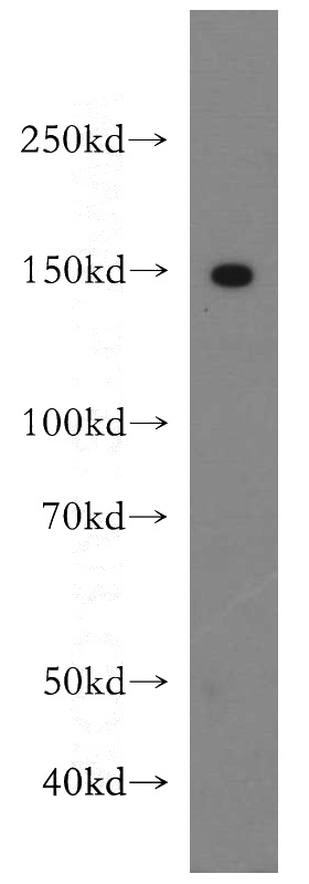 SGC-7901 cells were subjected to SDS PAGE followed by western blot with Catalog No:112157(LATS2-Specific antibody) at dilution of 1:500