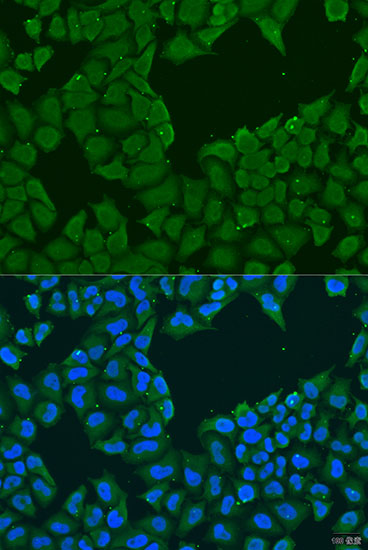 Immunofluorescence - MAGEA6 Polyclonal Antibody 