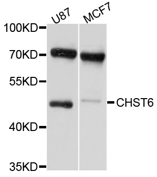 Western blot - CHST6 Polyclonal Antibody 
